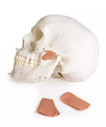 Model de craniu pentru stomatologie cu sindrom de disfuncție temporomandibulară, 8 piese