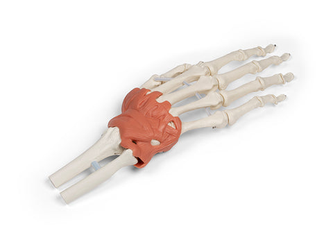 Aparat ligamentos al încheieturii mâinii