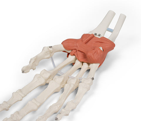Aparat ligamentos al încheieturii mâinii