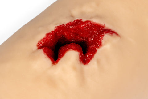 Antrenor pentru tamponarea plăgilor „Bill” cu fragmente osoase