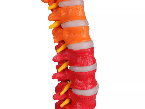 Coloană vertebrală flexibilă, didactică