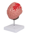 Patologii cerebrale