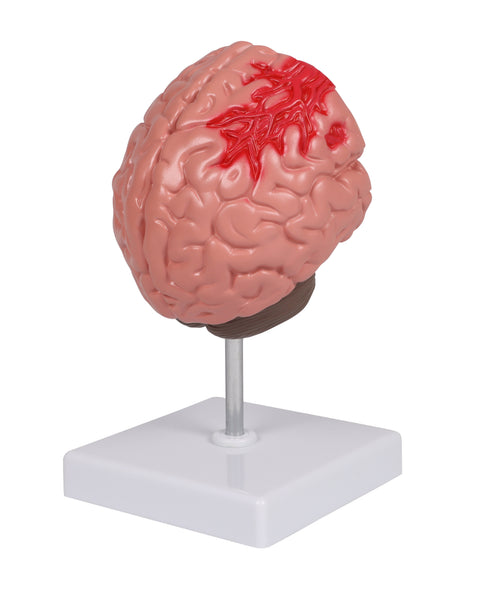 Patologii cerebrale