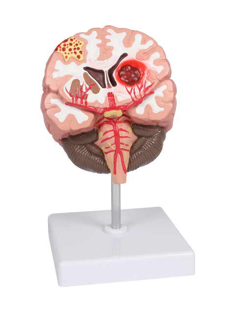 Patologii cerebrale