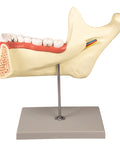 Maxilar inferior, 6 piese