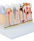 Model dentar, 4 ori mărime naturală - Anatomie augmentată EZ