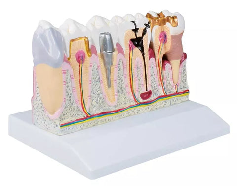Model dentar, 4 ori mărime naturală - Anatomie augmentată EZ