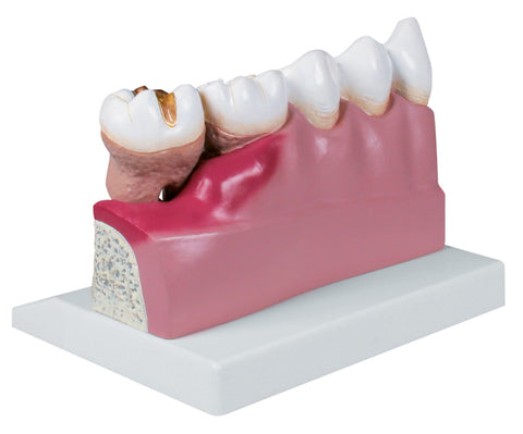 Model dentar, 4 ori mărime naturală - Anatomie augmentată EZ