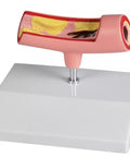 Model arteri
