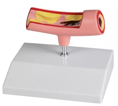 Model arteri