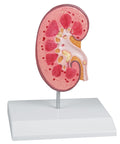 Model calculi renali - EZ Augmented Anatomy