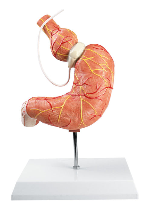 Model stomac cu bandă gastrică