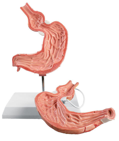 Model stomac cu bandă gastrică