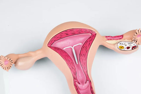 Model uter