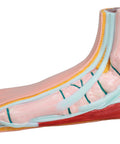 Picior plat, pes planus