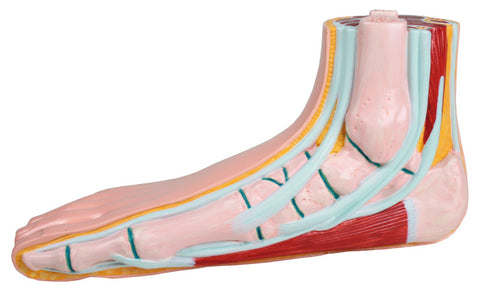Picior plat, pes planus