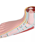 Picior plat, pes planus