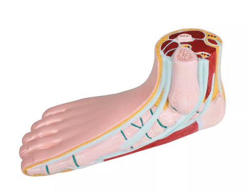 Picior plat, pes planus