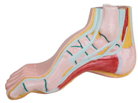 Picior scobit, pes cavus