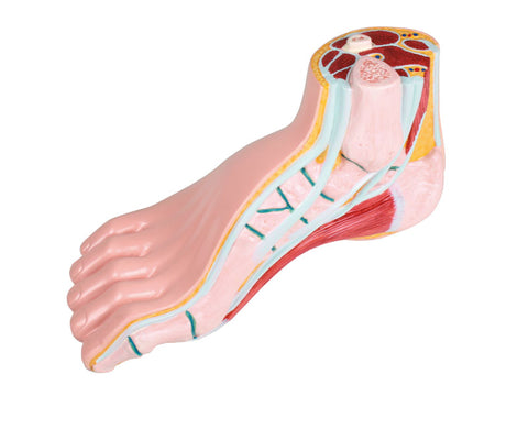 Picior scobit, pes cavus
