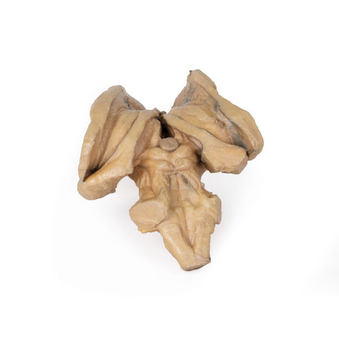 Trunchiul cerebral, structurile cerebrale profunde și diencefalice