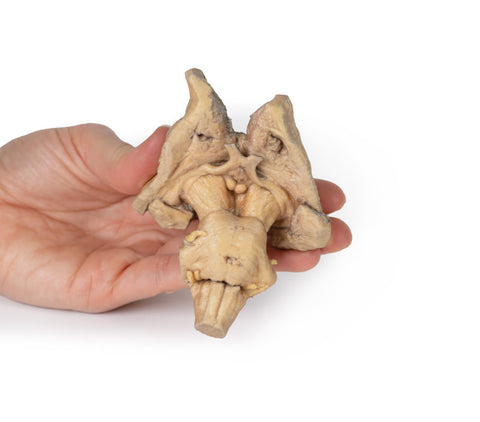 Trunchiul cerebral, structurile cerebrale profunde și diencefalice