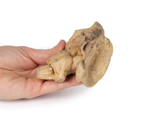 Trunchiul cerebral, structurile cerebrale profunde și diencefalice