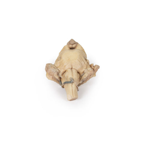 Trunchi cerebral, anatomie izolată de la mezencefal la medula oblongata