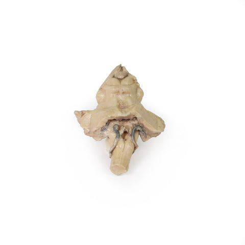 Trunchi cerebral, anatomie izolată de la mezencefal la medula oblongata