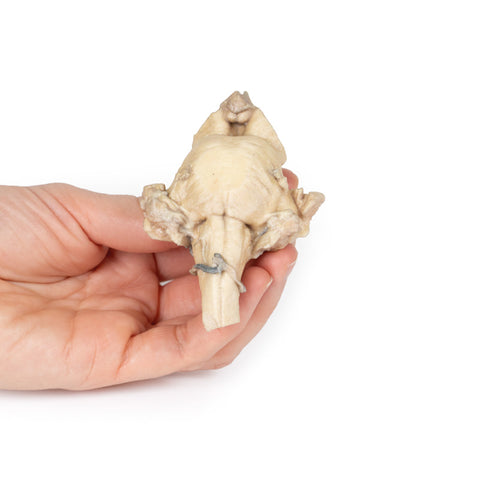 Trunchi cerebral, anatomie izolată de la mezencefal la medula oblongata