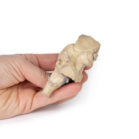 Trunchi cerebral, anatomie izolată de la mezencefal la medula oblongata
