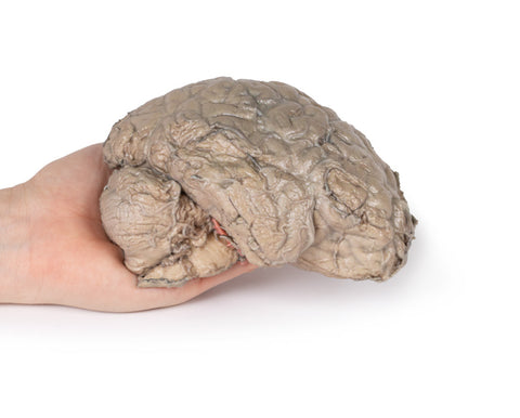 Hemisecțiune a creierului