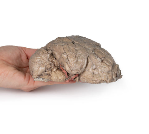 Hemisecțiune a creierului