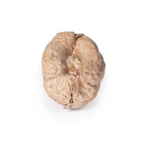 Creierul (cerebrum)