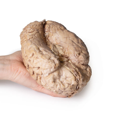 Creierul (cerebrum)