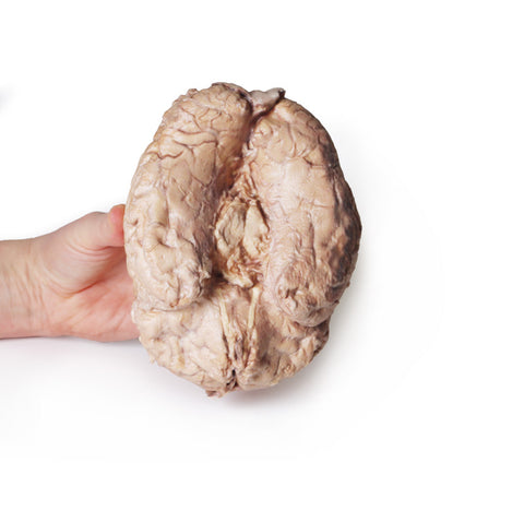 Creierul (cerebrum)