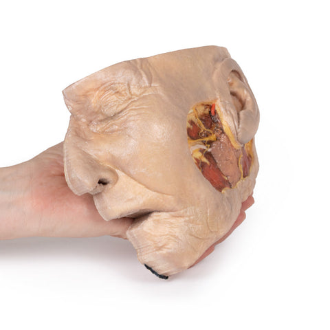 Disecția glandei parotide și a nervului facial