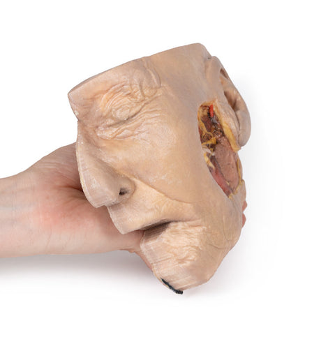 Disecția glandei parotide și a nervului facial