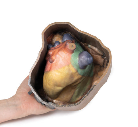 Spațiul pericardic