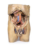 Abdomen cu hernii bilaterale