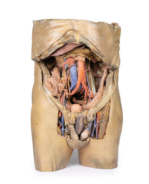 Abdomen cu hernii bilaterale