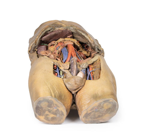 Abdomen cu hernii bilaterale