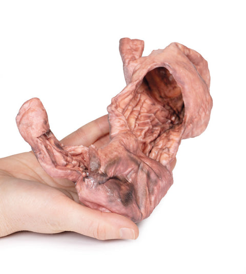 Stomac