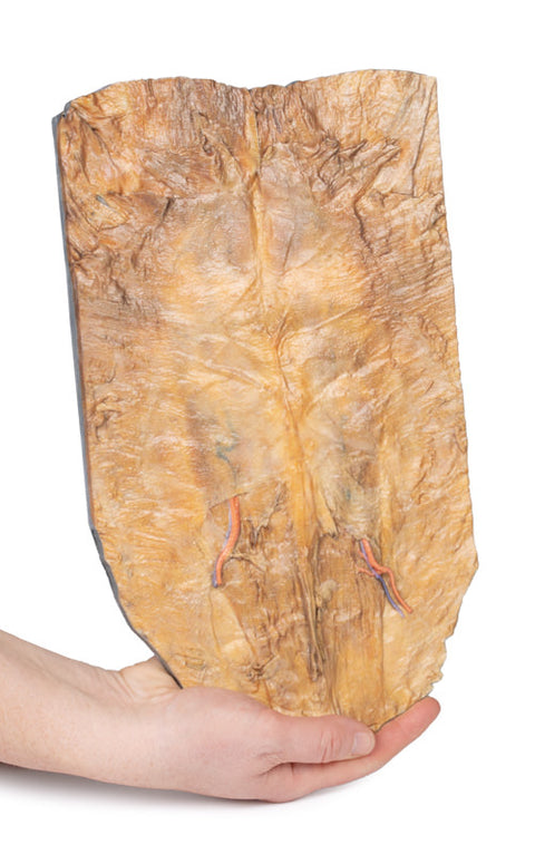 Peretele abdominal intern