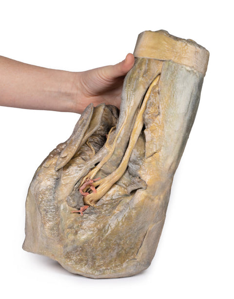 Hemipelvis și coapsă - feminin