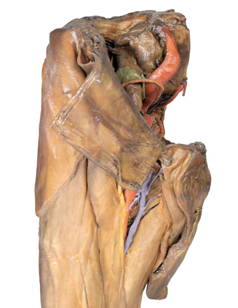 Hemipelvis masculin și coapsă