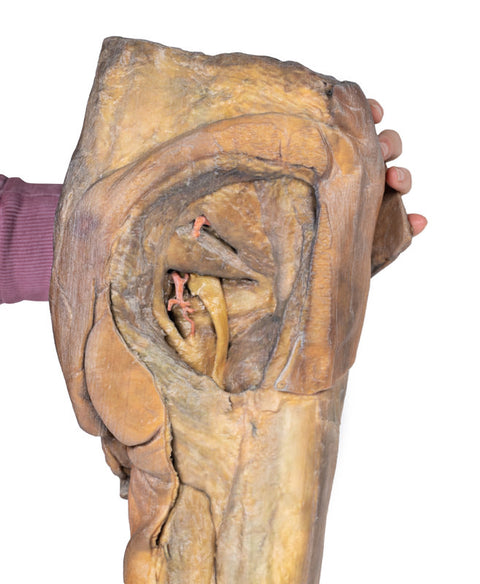 Hemipelvis masculin și coapsă