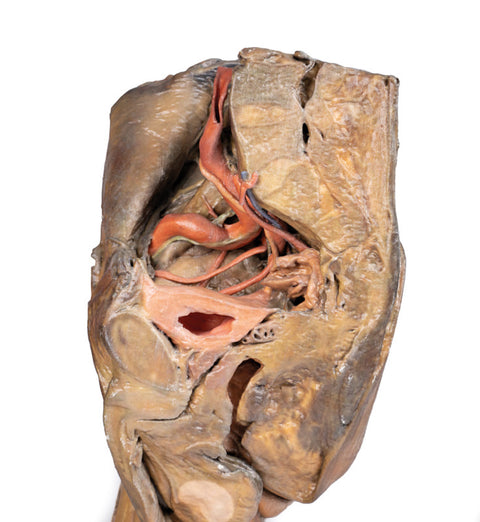 Hemipelvis masculin și coapsă