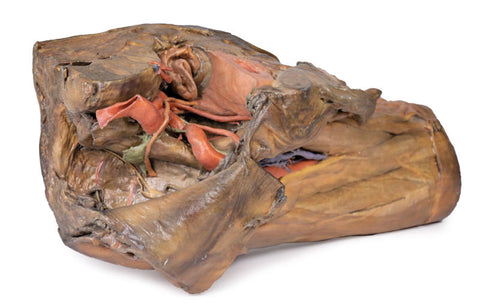 Hemipelvis masculin și coapsă