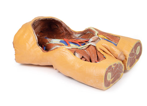 Peretele abdominal posterior